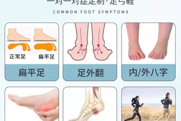 八字脚多的原因及如何缓解