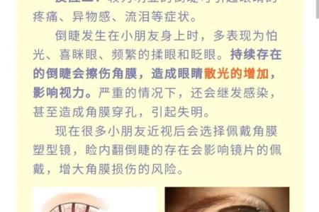 眼睛是倒八字