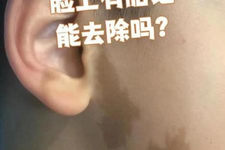 脸上胎记算命看运势