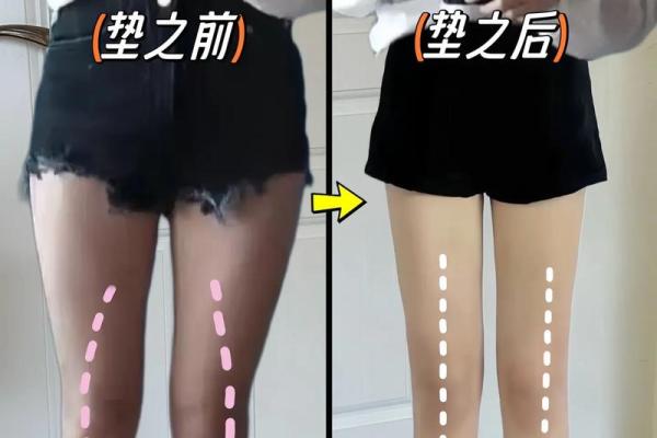 什么是内八字