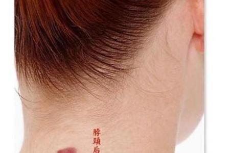 胎记算命讲解