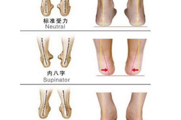 女生外八字