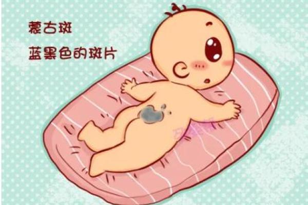 看脸上胎记如何算命